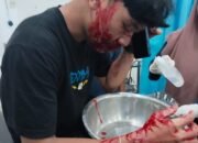 Pria Asal Sergai Dibacok Kawanan Begal di Simpang Tiga Perbaungan